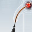 (image for) Roselex Urethral Vibrator