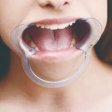(image for) Cheek Retractor Dental Mouth Gag
